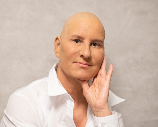 Ile lat się żyje po chemioterapii?